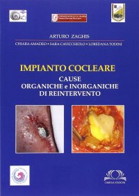 Immagine copertina libro Impianto cocleare. Cause organiche e inorganiche di reintervento. Ediz. illustrata